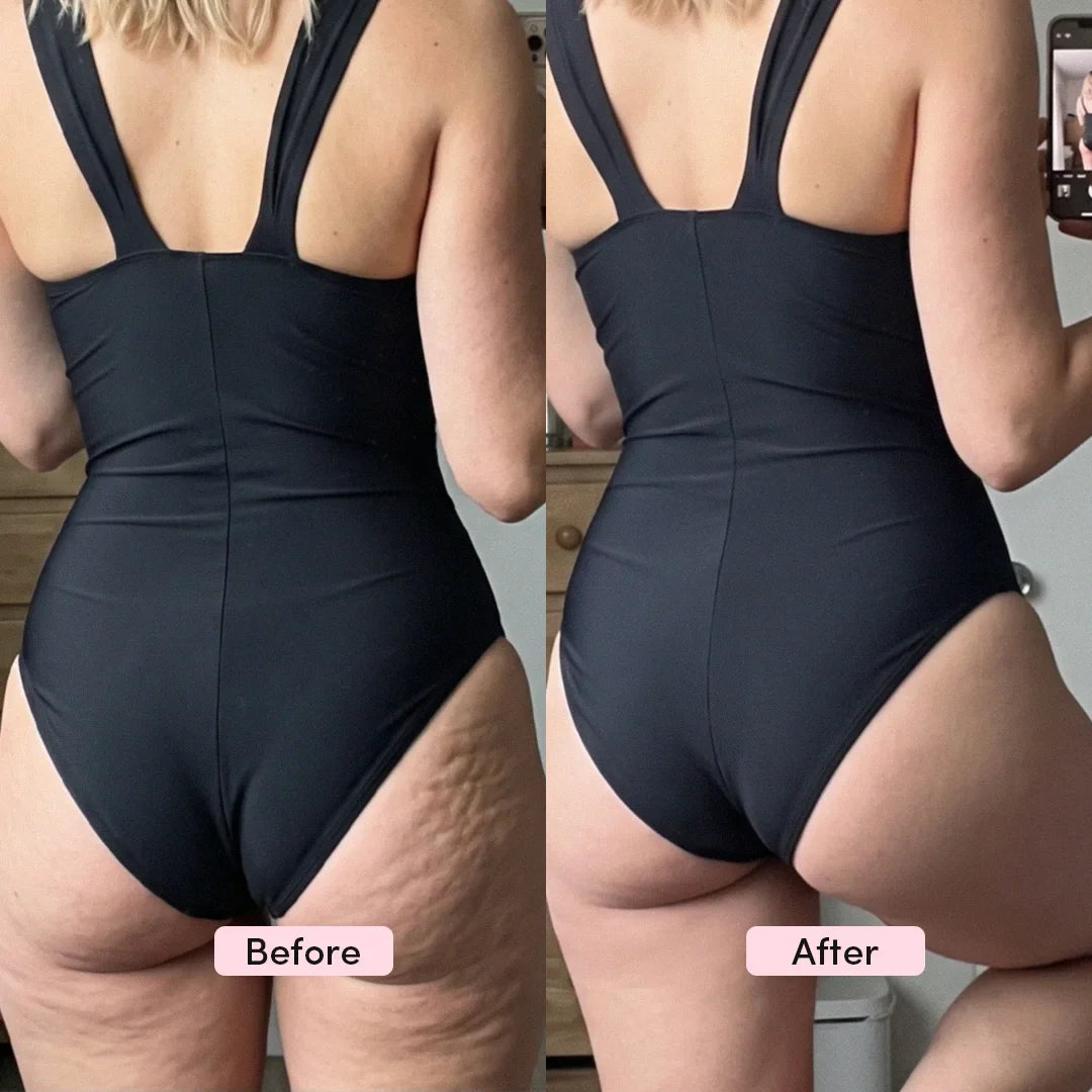 Dames Bodyshaper 3-in-1 Naadloze Shapewear Body
